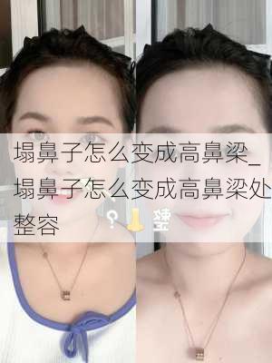 塌鼻子怎么变成高鼻梁_塌鼻子怎么变成高鼻梁处整容