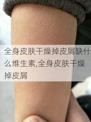 全身皮肤干燥掉皮屑缺什么维生素,全身皮肤干燥掉皮屑